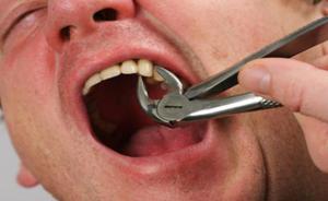 Как без боли вырвать зуб