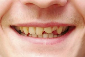 Показания для обращения к врачу ортопеду стоматологу