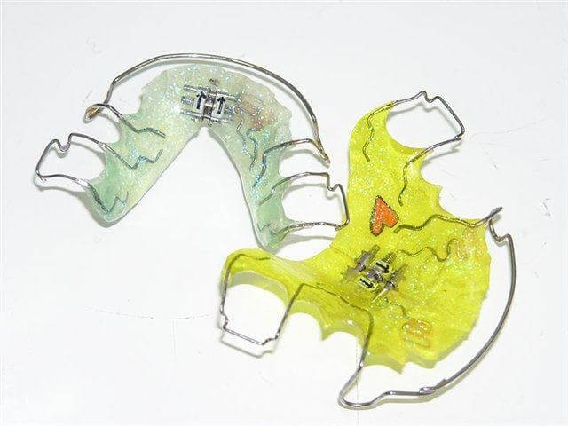 Съемные конструкции в ортодонтии
