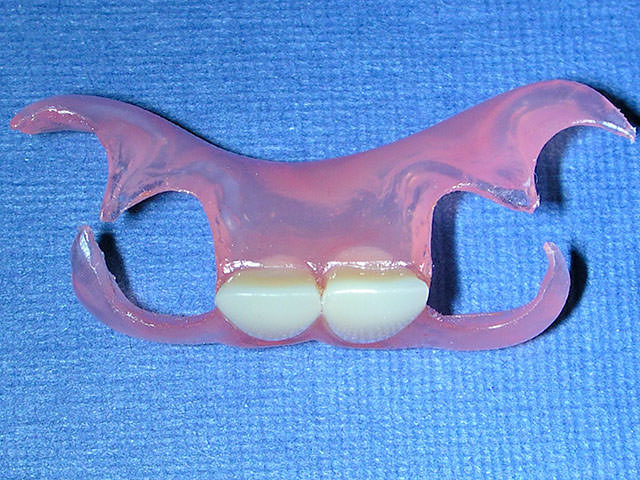 Протез для двух передних зубов