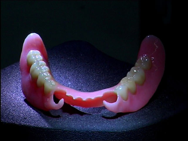 Съемный протез для зубов 