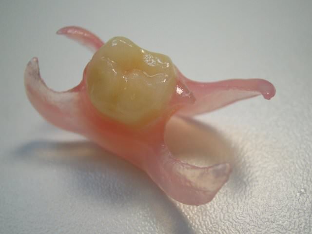 Съемный зубной протез для одного зуба