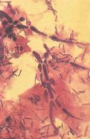 грибок кандида под микроскопом
