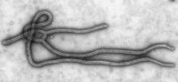 вирус Эбола под микроскопом