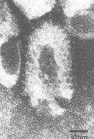 вирус бешенства под микроскопом - похож на пулю