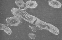Микобактерия туберкулёза (электронная микроскопия)