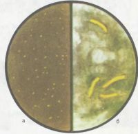 Микобактерия туберкулеза при увеличении 70 (слева) и 630 (справа) (люминесцентная микроскопия)