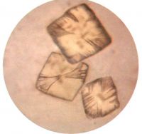 мелкие кристаллы мочевой кислоты