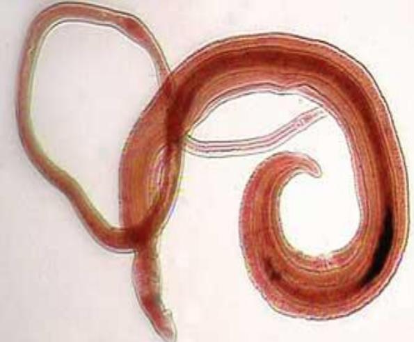 Микрофотография препарата яиц Schistosoma haematobium