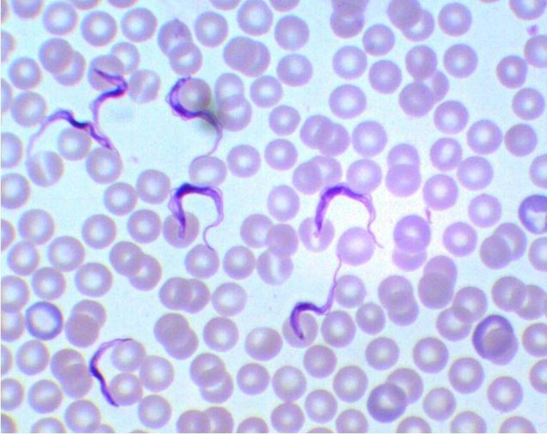 Trypanosoma gambience в препарата крови
